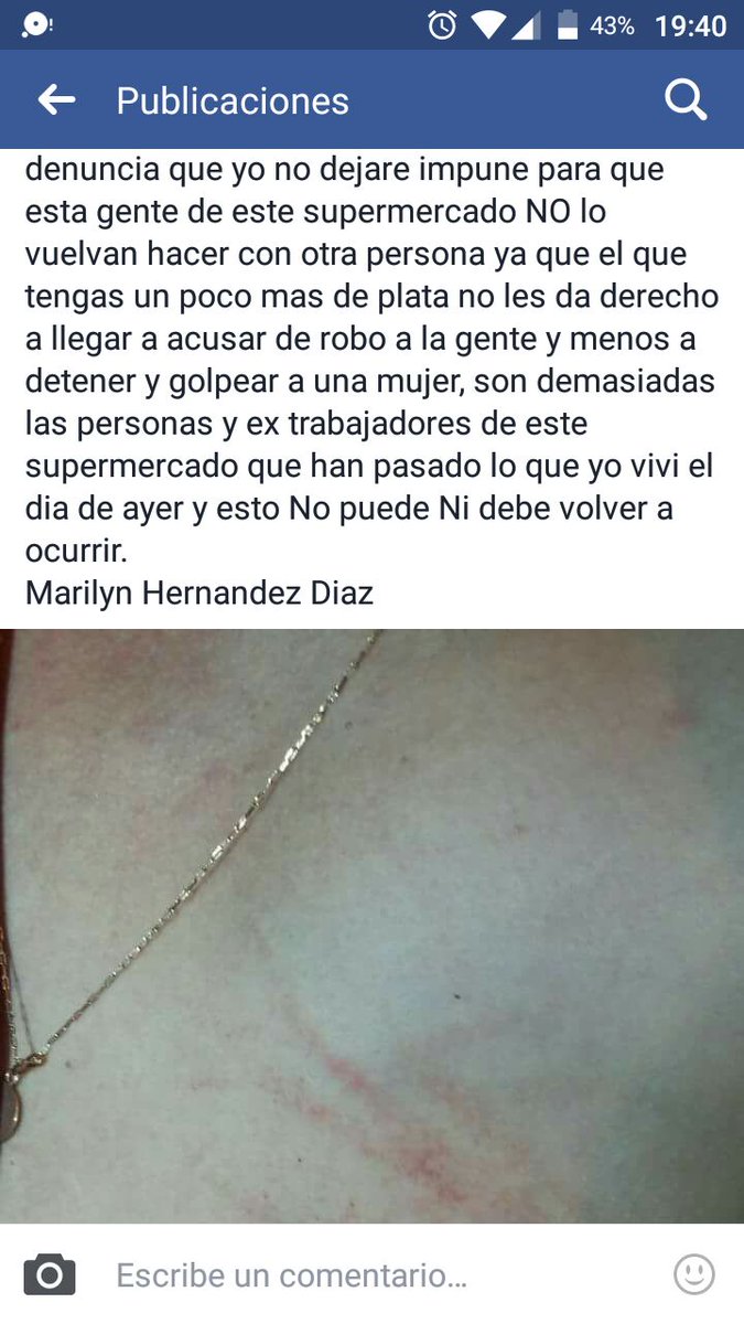wladimir_UB's tweet photo. Esto es un abuso y un delito que no debe quedar impune. @SoledadOnetto @ellanquihuecl @biobio #NiUnaMenos #maltratomujer @latercera https://t.co/XhokLmRb0y
