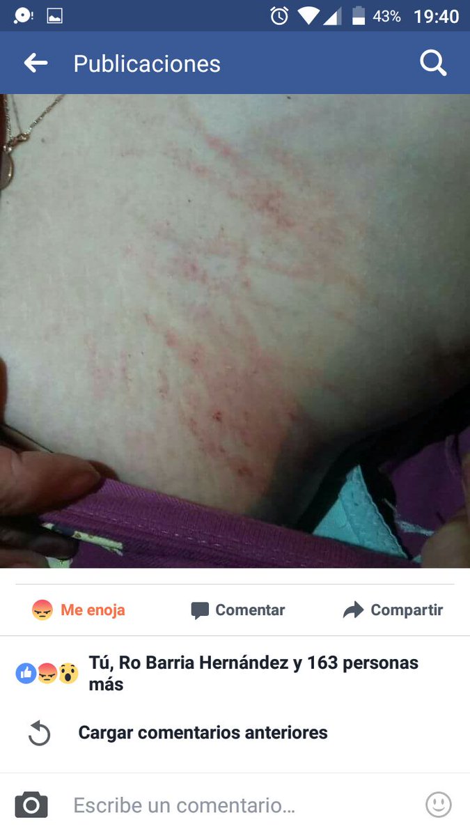 wladimir_UB's tweet photo. Esto es un abuso y un delito que no debe quedar impune. @SoledadOnetto @ellanquihuecl @biobio #NiUnaMenos #maltratomujer @latercera https://t.co/XhokLmRb0y