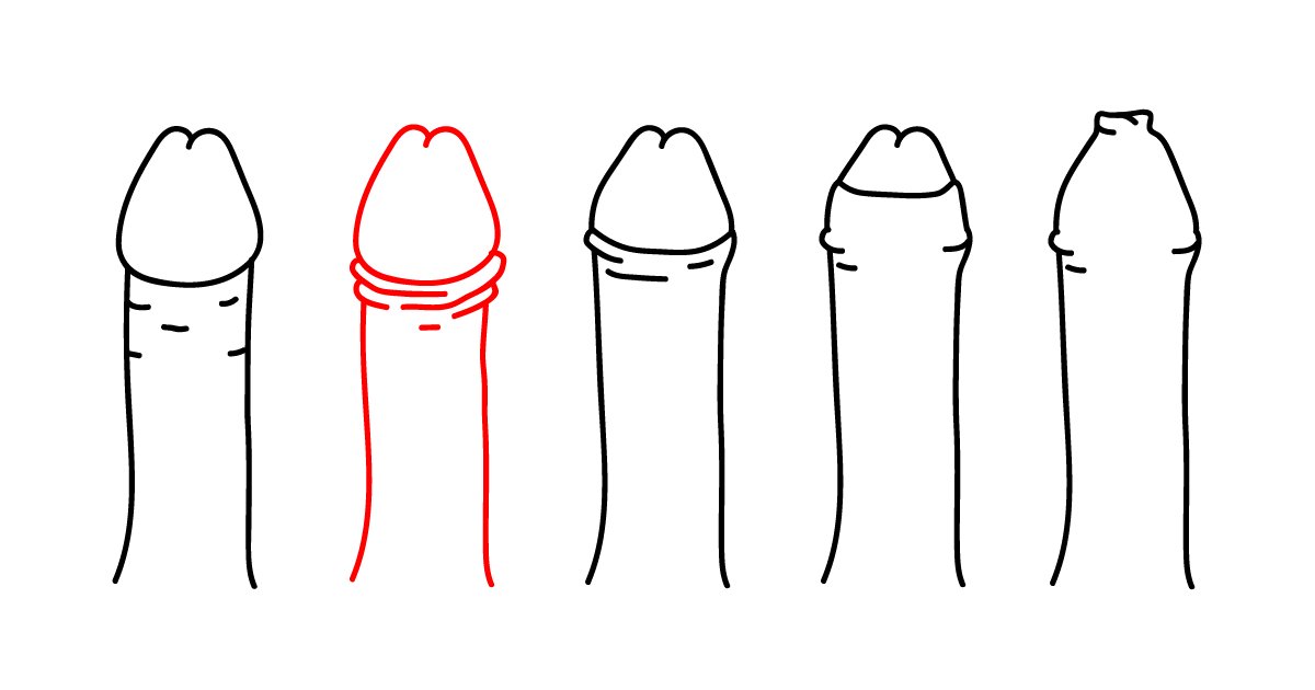 adultchannel's tweet photo. Do u know the #dickcode https://t.co/QBRIHvkqYv & the #vaginacode https://t.co/aJgm1dqfms Basically, it's like a CV of your penis or vagina https://t.co/g7dJclqNTB