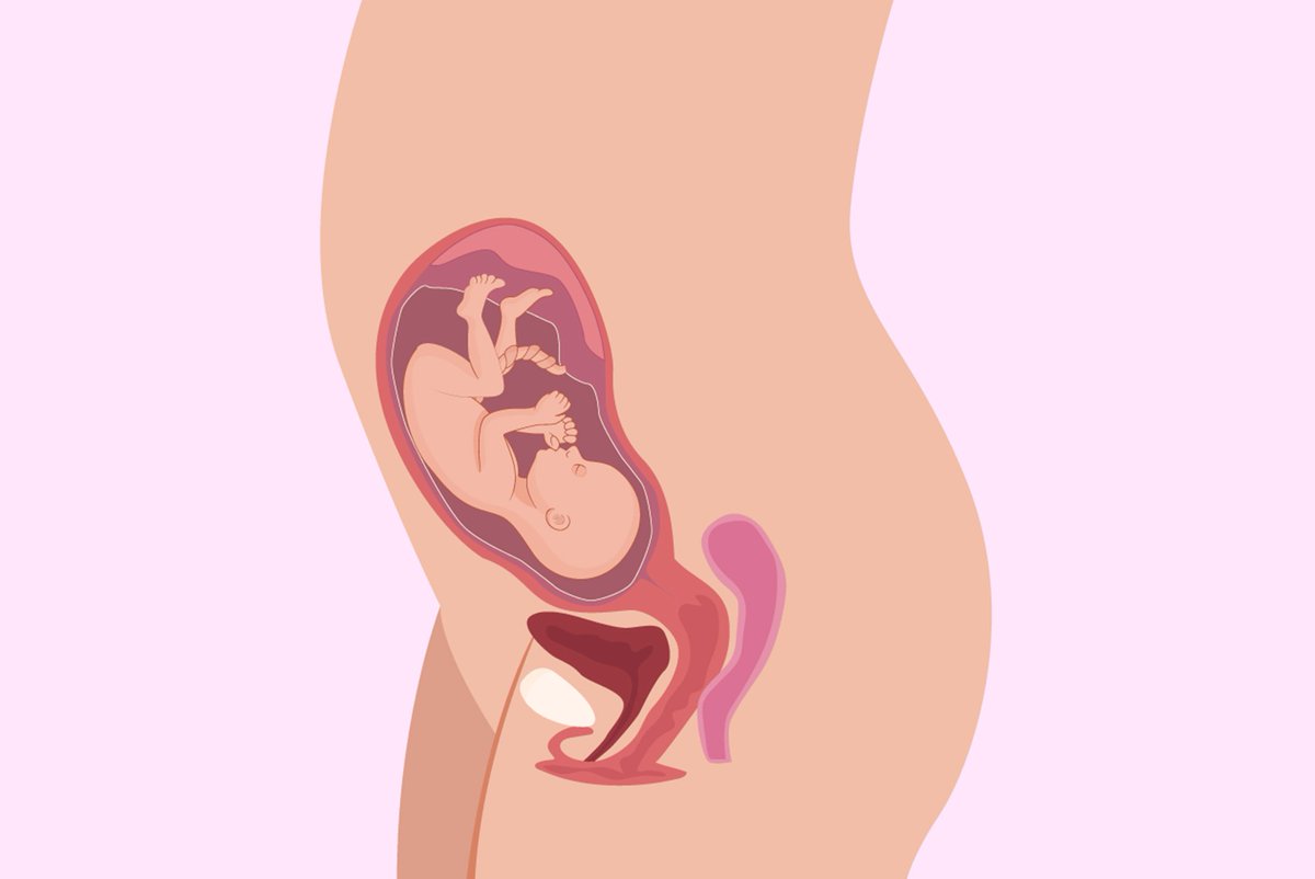 testkx's tweet image. Una de las preguntas que más se hace al obstetra durante las revisiones del embarazo es si el bebé está bien colocado. #testkx