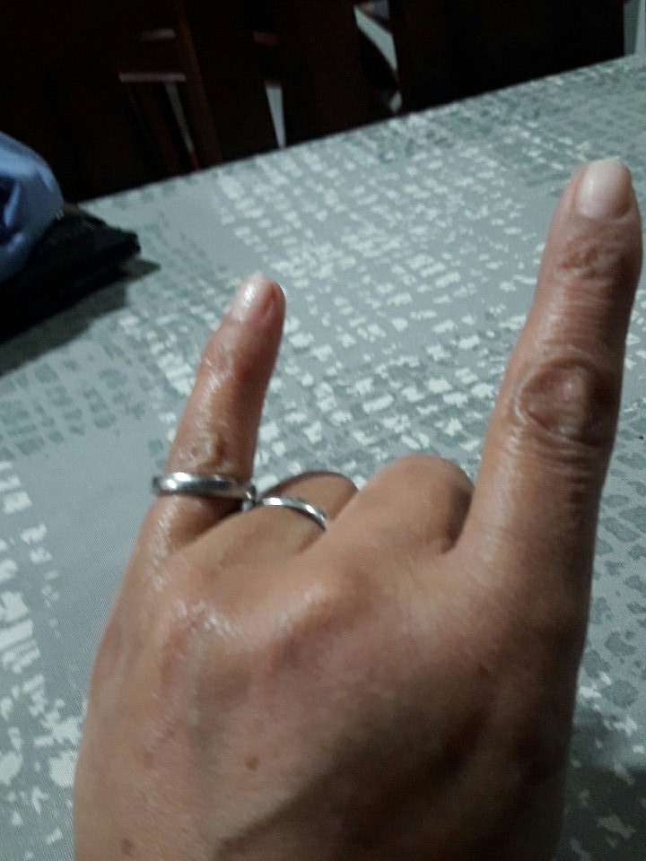 lydeOxum's tweet photo. #CuernoTerapia no mando mi cara xq stoy con conjuntivitis 😓😓😓😎. Desde Moreno los escucho a full https://t.co/c7yBJxxEha