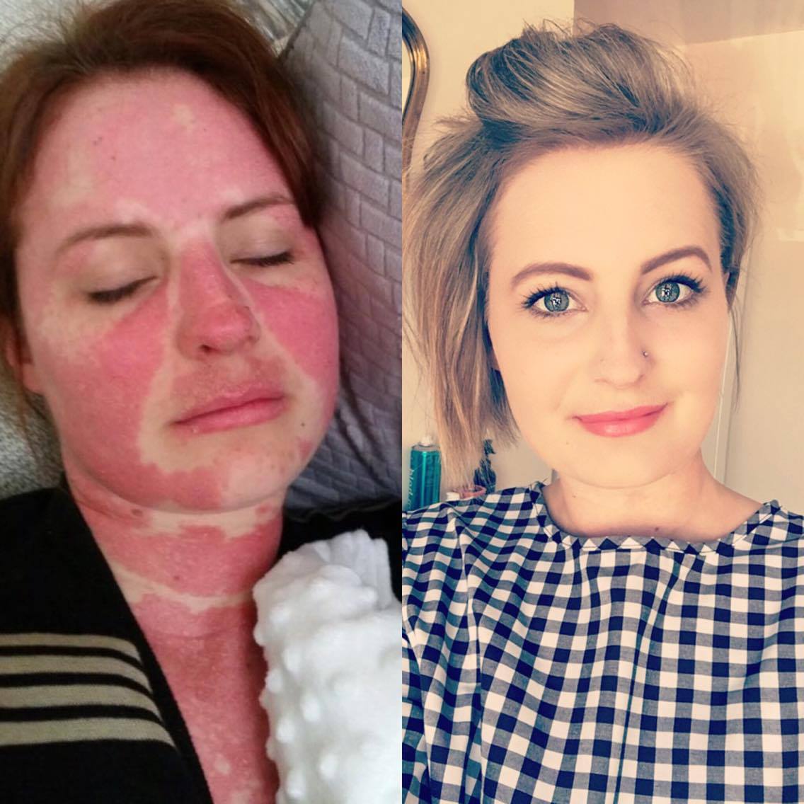 rarediseaseuk's tweet photo. Today is #WorldLupusDay. Lauren has written about living with #lupus for our Patient Experiences Blog https://t.co/LJB0n31Qty @LUPUSUK https://t.co/GJB7gRTCkt