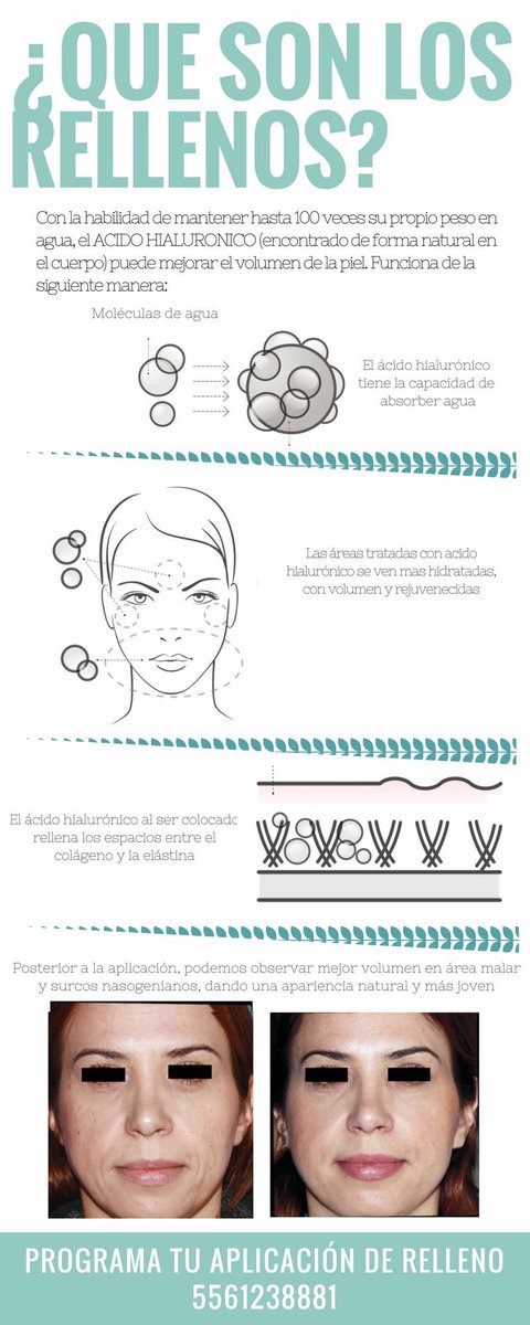 BotoxCDMX's tweet image. Qué son los rellenos? #botoxcdmx