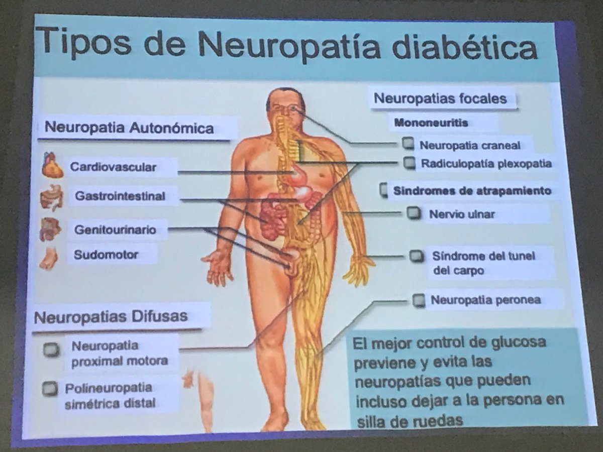 neuropatía diabetes reino unido