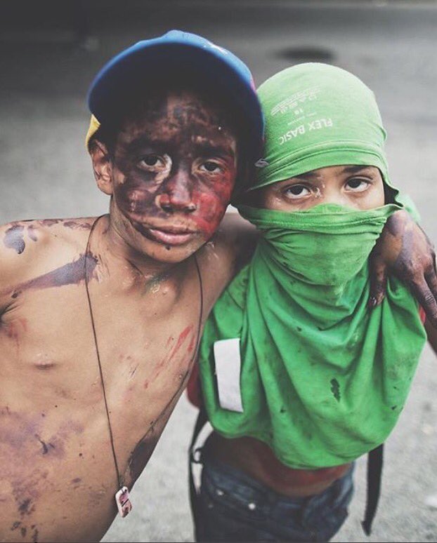 eldiario's tweet photo. Viven en las Calles y nacieron en dictadura, producto de un experimento fracasado de Chávez, hoy son Soldados por la Libertad https://t.co/RJG2hxRaAF