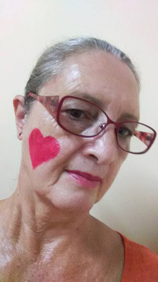 VBirthmarks's tweet photo. We are loving all the #PutOnYourBirthmark photos! Keep them coming all month long, #VBFAwareness https://t.co/GlTwYPKamq