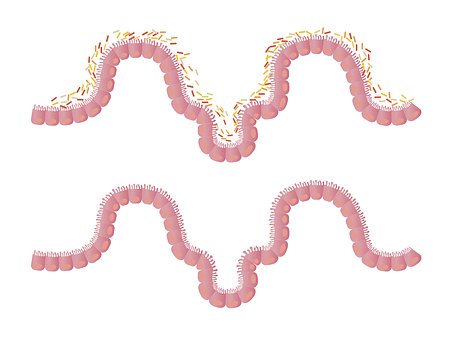 onethgroup's tweet photo. # News: Tweaking the gut microbiome may hold promise for fighting stress. https://t.co/IELG67gu0o #ONethGroup #PTSD #CPTSD #MentalHealth https://t.co/Y4NTuBml03