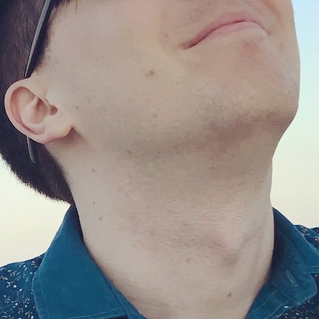 asleepyhoweII's tweet image. LOOK AT ALL THESE FRECKLES IM BLESSED