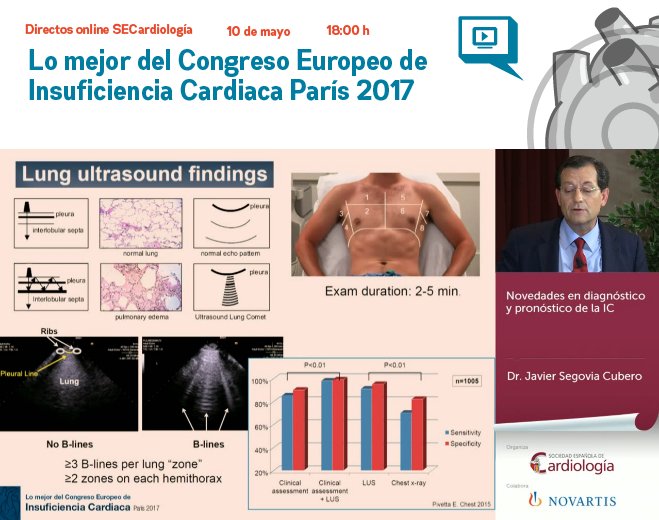 secardiologia's tweet photo. Dr. Javier Segovia: "El ECO pulmonar aporta importante información diagnóstica y pronóstica en pacientes con IC"
#postIC17 https://t.co/eh1DdXrjiY