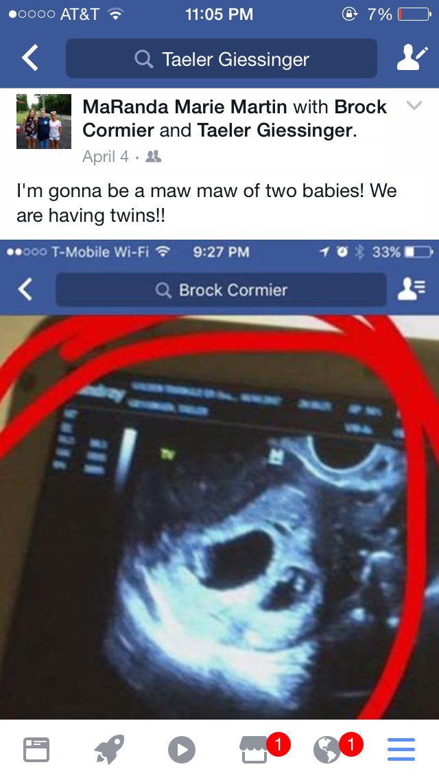 taeler_celeste's tweet photo. March 31st "Better not be true"
April 4th , We got a unexpected shock. But I couldn't me any happier. ❤️😍
#BlessedWithTwo https://t.co/gdQeaWOpyn