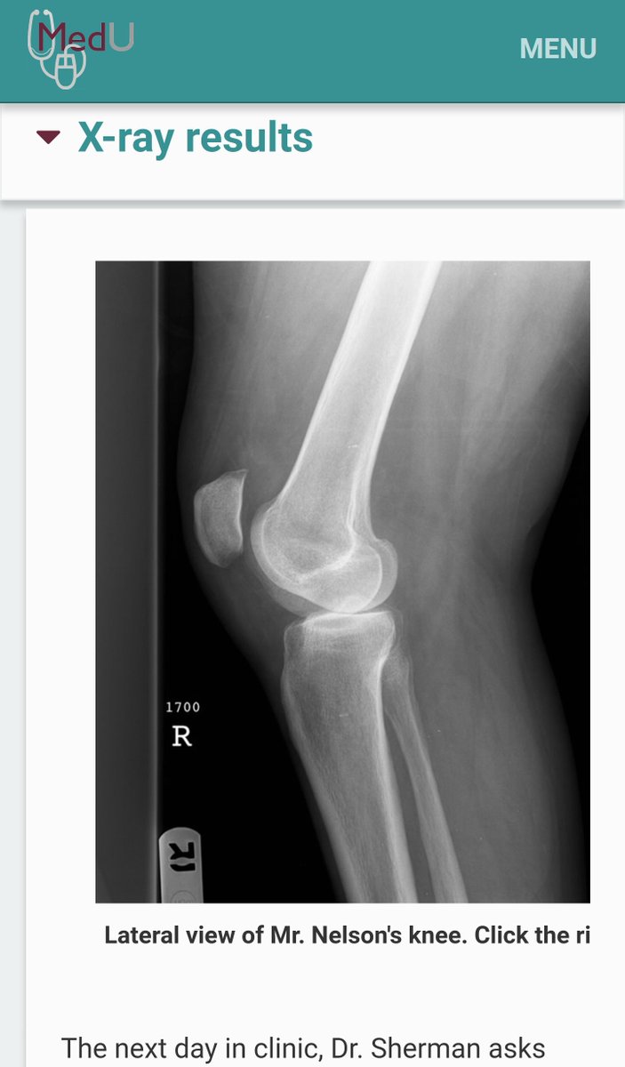 MedUmatters's tweet photo. CORE Case-based #radiology #meded (https://t.co/r1NYuvf2Js) course be available on MedU's updated mobile-friendly platform in June. #aur17 https://t.co/yXphy8VMHA