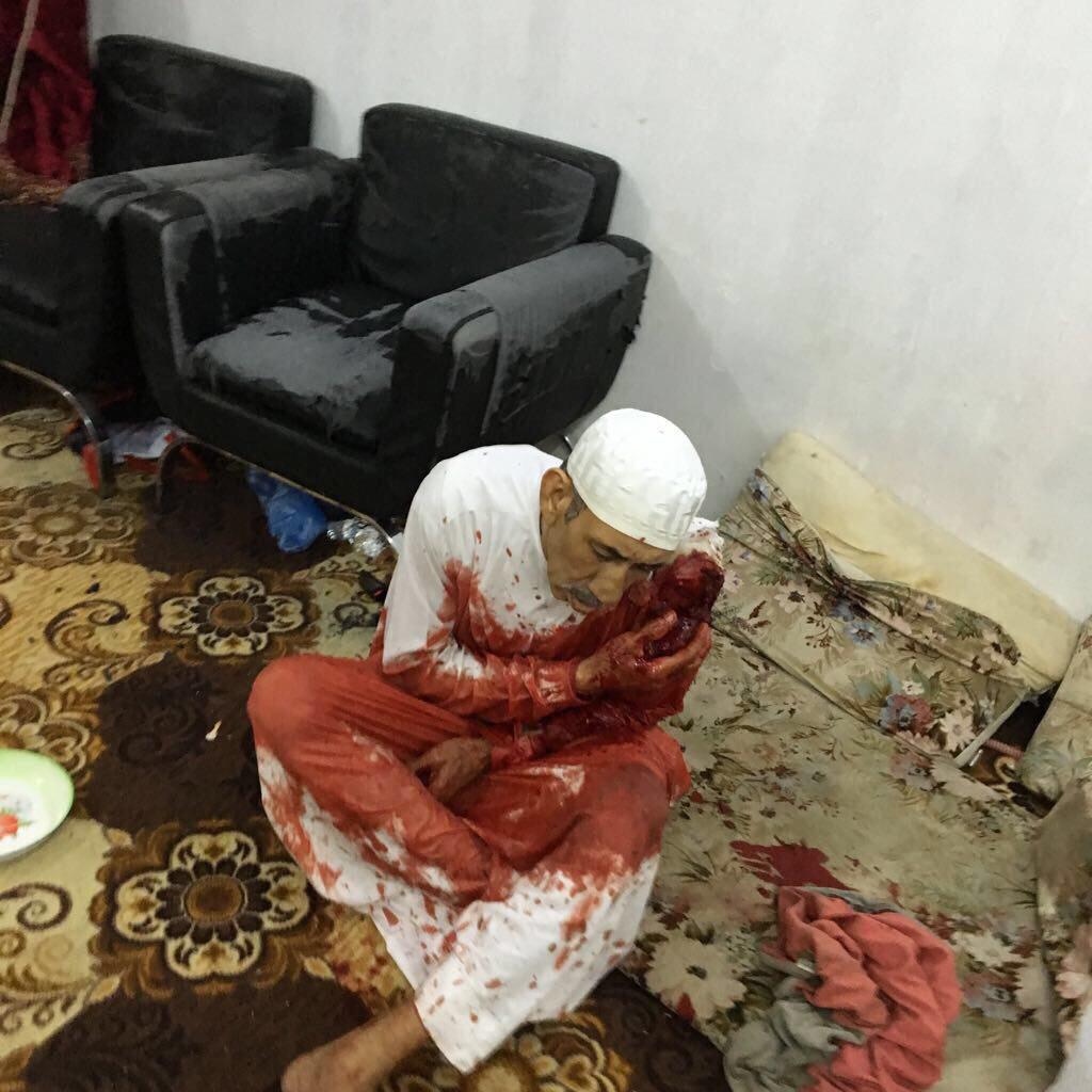 ali_adubisi's tweet photo. إصابة بليغة لرجل مسن في العوامية الحاج حسن الشبيب جراء الرصاص العشوائي الذي تطلقه القوات #السعودية في مداهمة موسعة مستمرة على مدينة العوامية https://t.co/LWjVwsulE7
