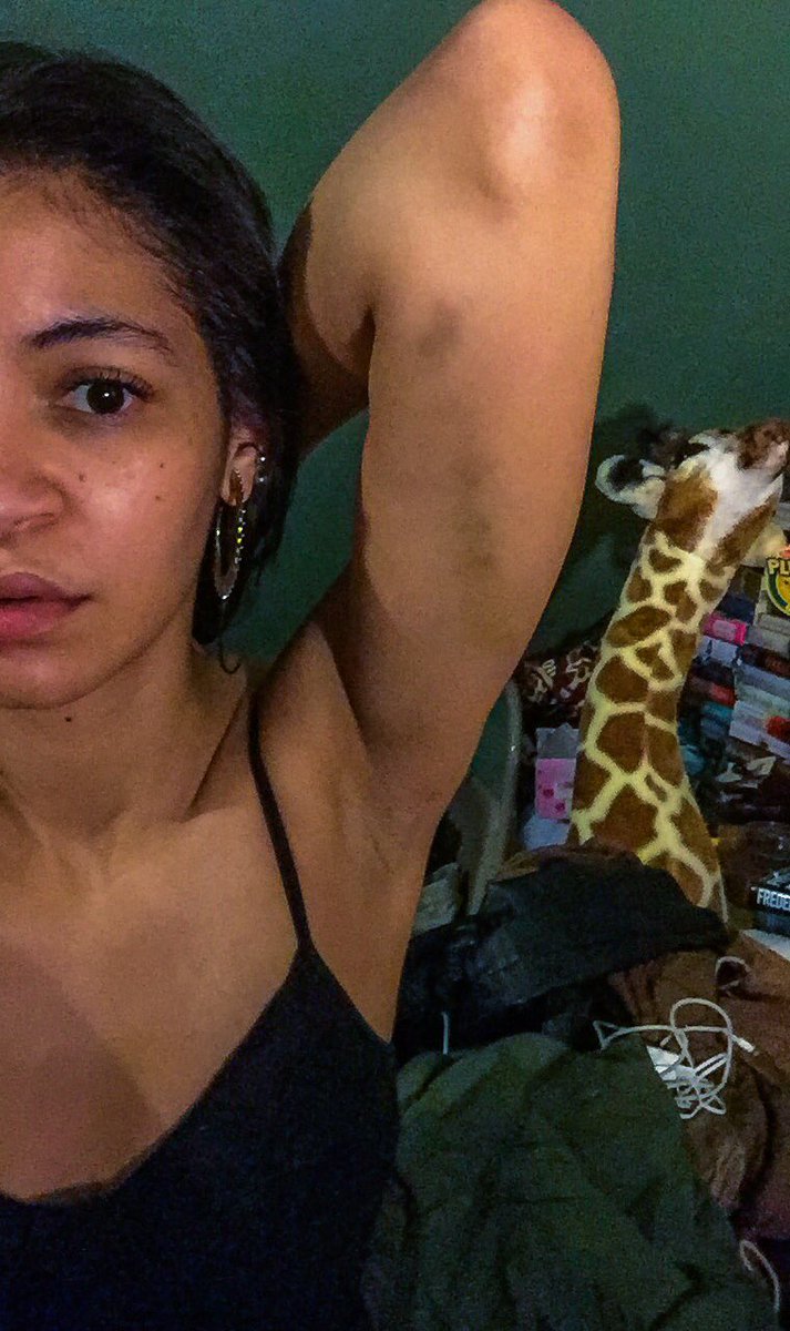 072292's tweet photo. Chronicles of Tai the Klutz part 145,897: #wakeupwithbruises #wheretf #howtf #wtf #whyme https://t.co/RNOp2jJ6Pm