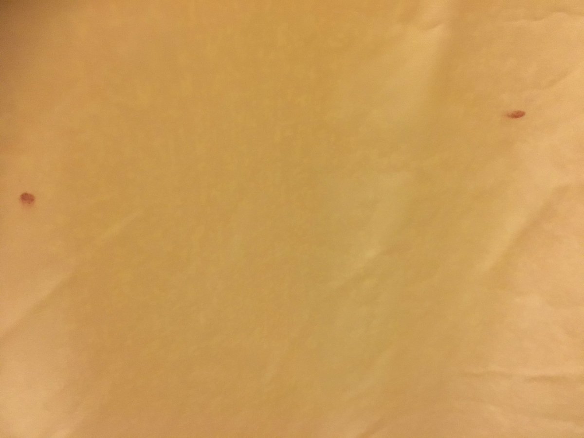 GOPElephant's tweet photo. Staying at one of the @WaltDisneyWorld resorts, &amp; found what looks suspiciously like blood on shower curtain #disgusting #WDW #disneyworld https://t.co/WAYAywnVFv