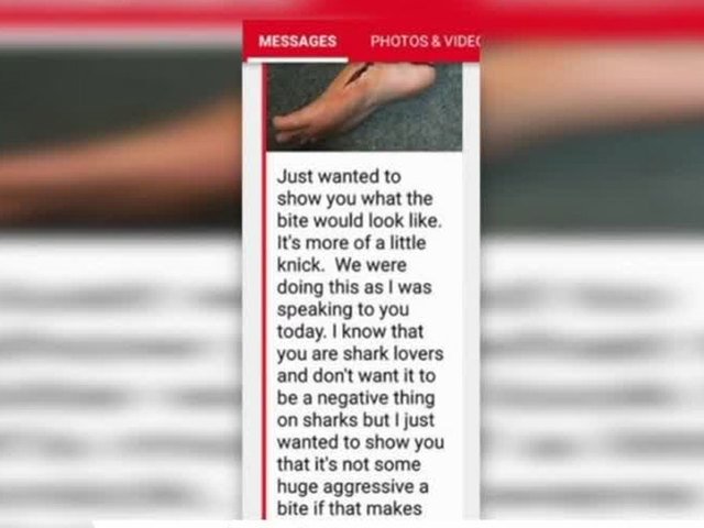 LiveHotGirls's tweet photo. The whole Shark Bite YouTube video story that @CamSodaLive and @IamMollyCavalli created is FAKE:  https://t.co/ktI8aaJz2n  #SharkLivesMatter https://t.co/r278kB54Eu