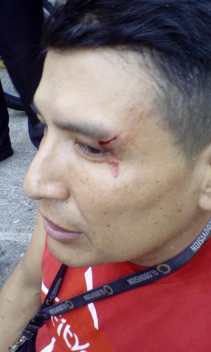 BernardoLuzardo's tweet photo. 1-Denuncio y condeno salvaje agresión q nuevament sufrimos equipo Globovision,estuvimos a punto d ser linchados por manifestantes opositores https://t.co/fGr8hshk5h