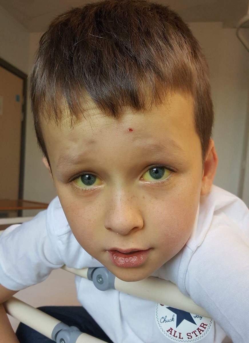 dabeast333's tweet photo. BREAKING: Jay is 10, from Fife - and we urgently need to find him a stem cell... https://t.co/zWXAACiPhL by #akjc77 via @c0nvey https://t.co/kBScyyS67t