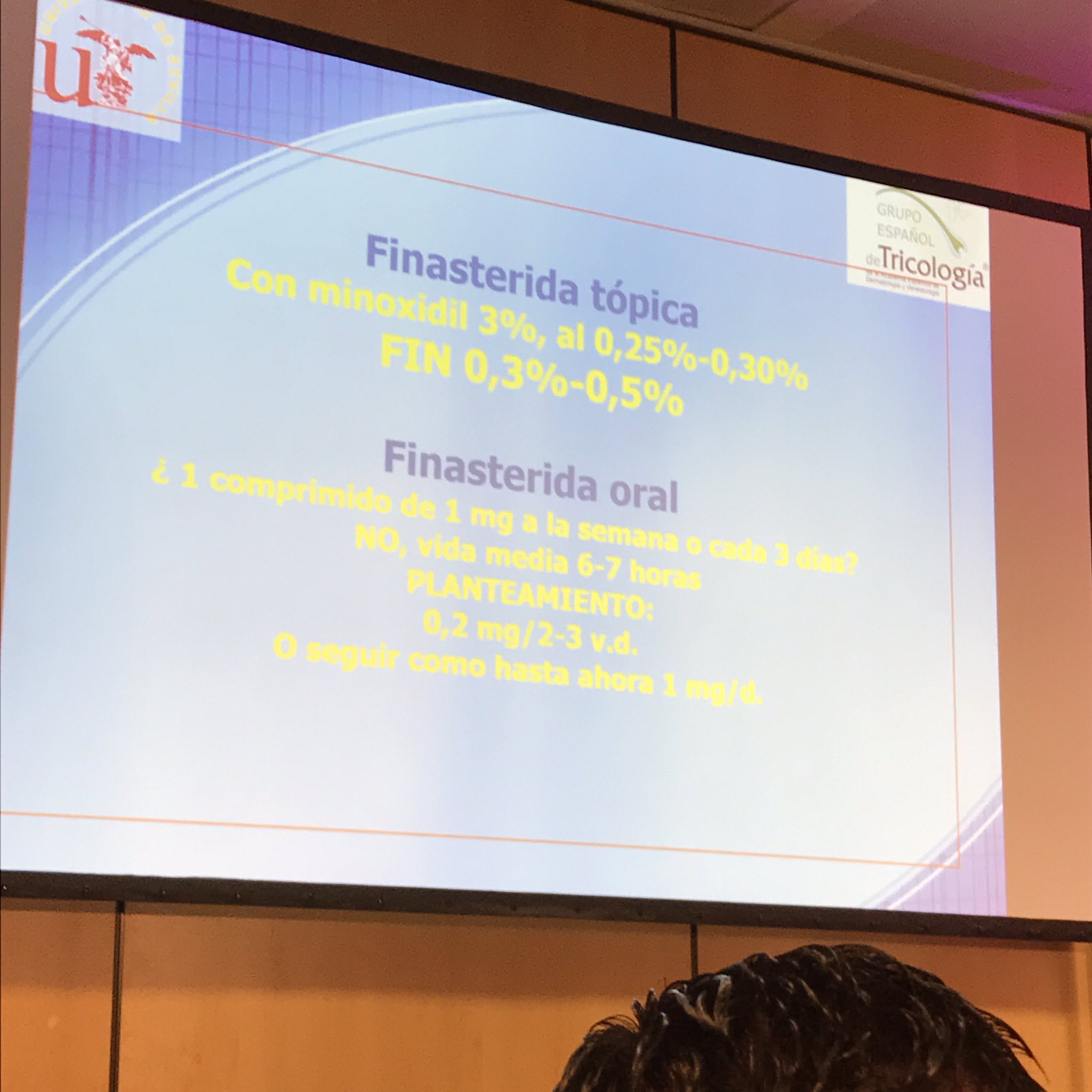 finasteride 1 mg españa