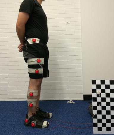 SpringerEng's tweet image. Change the world: This paper allows us to understand how athletes with disabilities can run better buff.ly/2q6aZMI #SN_OneEarth