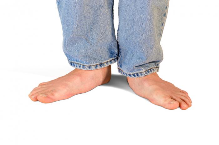 Les #piedsplats sont responsables de douleurs aux pieds ainsi qu'aux jambes, genoux, hanches et au dos. podiatre.pro/problemes-pied…