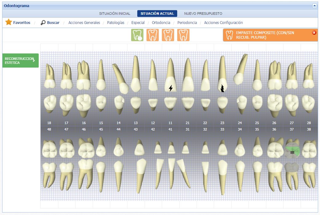 omi360health's tweet photo. Omi360 dispone de un #odontograma interactivo muy fácil de usar que le permite registrar la información #dental de sus #pacientes https://t.co/87dDFHcYxD