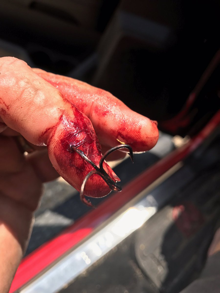 UltimateBass's tweet photo. This is what happens when you aren't careful with a treble hook... https://t.co/5KKiFx78jx