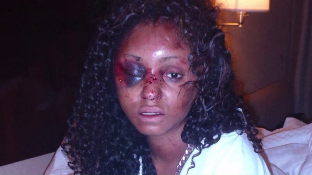 PMaziduli's tweet photo. Woman Shares Details of Assault During Date With Man She Met on Instagram https://t.co/iEp9FLilcB by #DJFreshSA via @c0nvey https://t.co/LUFwYLIQkn