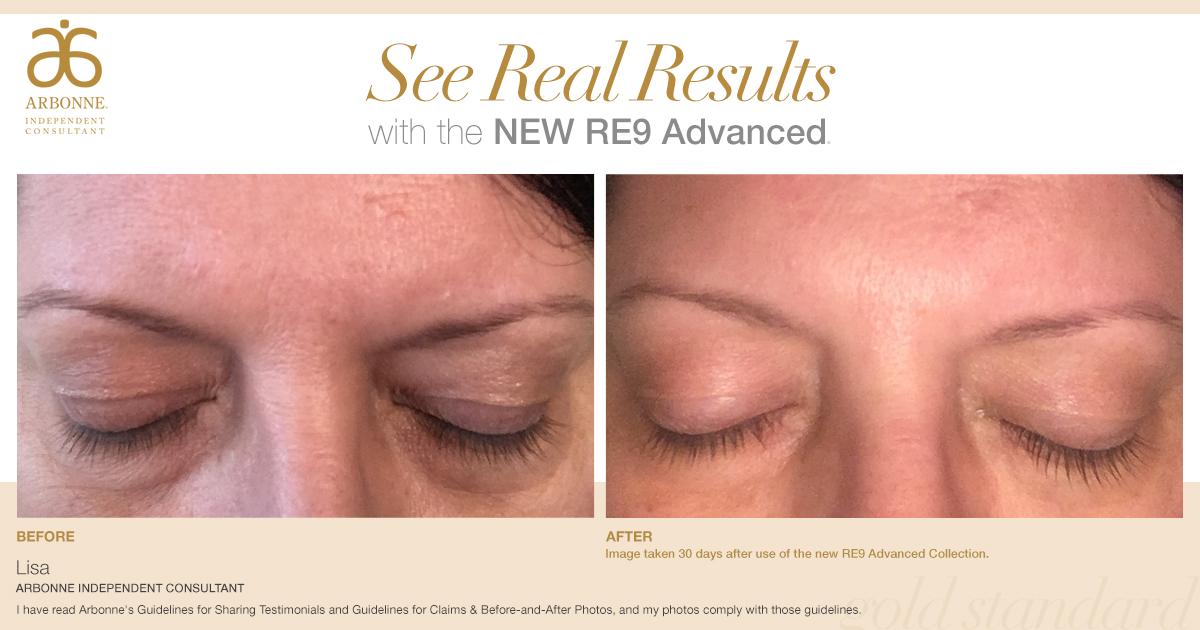 #RealRE9Results. Take the 30-day challenge for Great Skin and see the results for yourself! bit.ly/2q978wB #BeforeandAfter #Arbonne