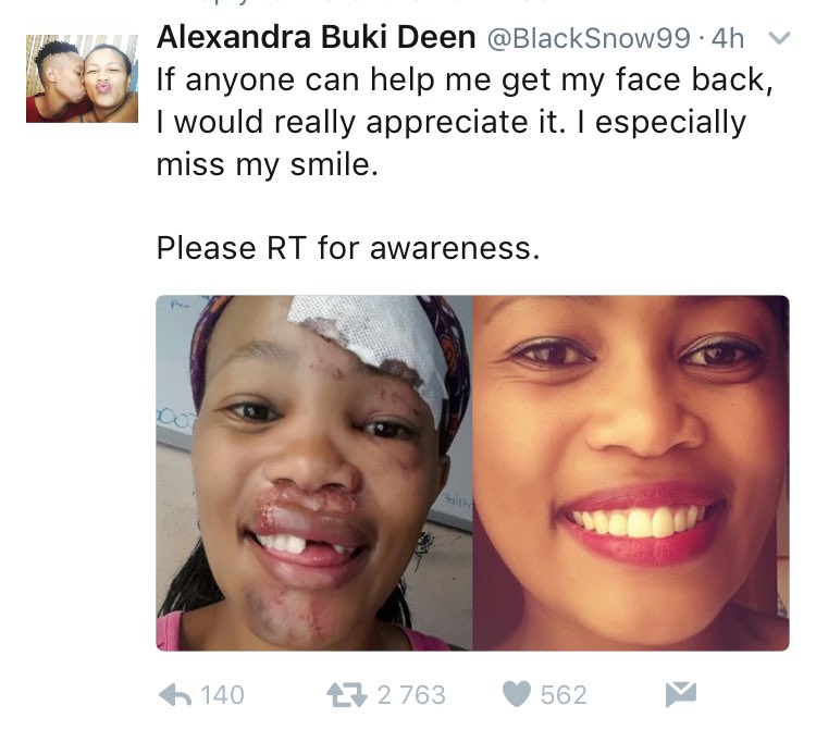Mweli Masilela tweet media