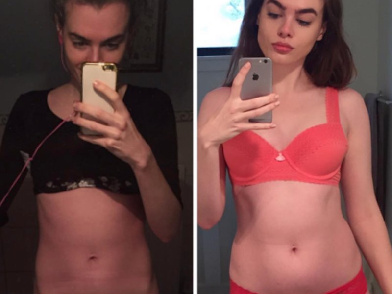 USA_Healthy_'s tweet photo. RT: 16 powerful before-and-after photos that prove numbers on a scale don&amp;#039;t matter https://t.co/FZTxfWV6mC https://t.co/2woJrWObeY