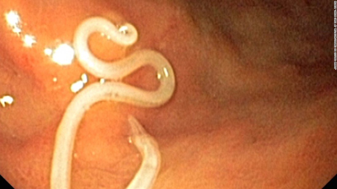 SYKEDOUTPRODUCT's tweet photo. Western countries are learning what Japan already knows: Parasites could be lurking... https://t.co/EAMzFOZtyP by #cnnbrk via @c0nvey https://t.co/yW8OxaCXxC