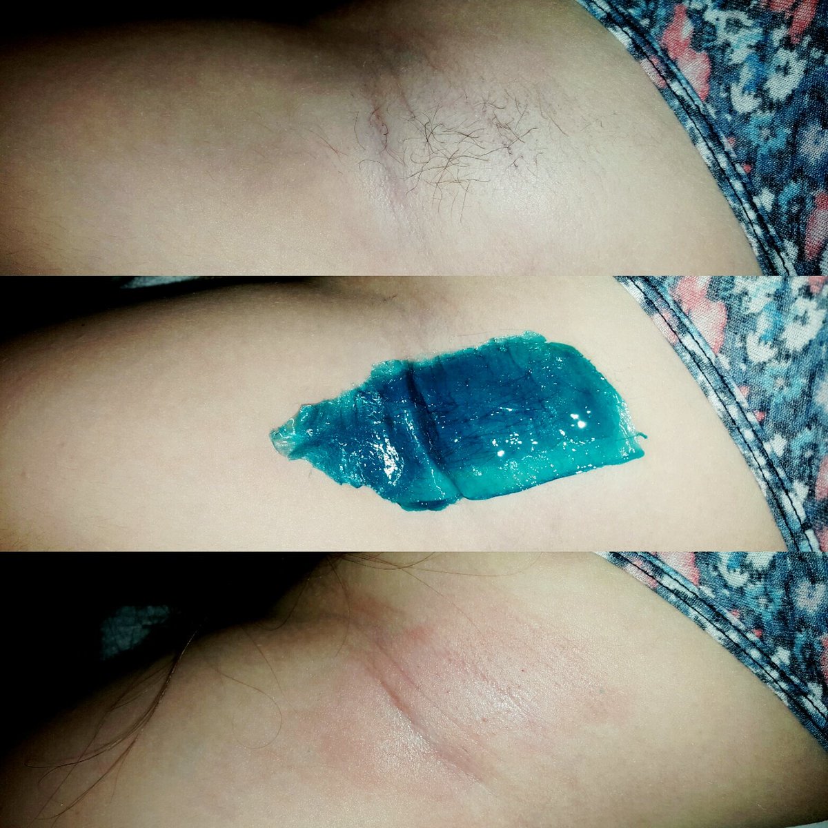 EstheticAngel's tweet photo. My daughters u/arms! 14 and  has no problem with them being waxed! It takes a whole 5 min to do them! #lastsawholemonth #giveitatry #waxing https://t.co/6lAGKfdXvX