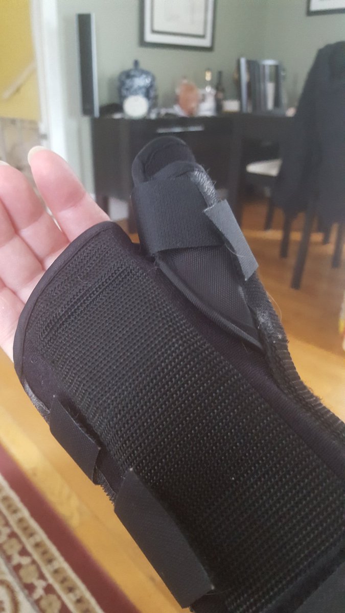 kellieh65's tweet photo. Hoping this splint works out.  #triggerthumbgonewrong #tendonreattached #justneedtoheal https://t.co/sQZA3USWAZ