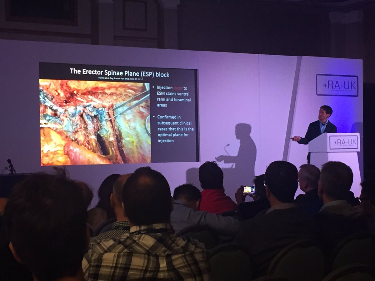 David (@davidbstl) on Twitter photo #RAUK17 <a href="/KiJinnChin/">Ki Jinn Chin</a> Talking the UK through Erector Spinae Plane Blocks... a superficial paravertebral with potential spread T2-L2. #RAUK17 <a href="/KiJinnChin/">Ki Jinn Chin</a> Talking the UK through Erector Spinae Plane Blocks... a superficial paravertebral with potential spread T2-L2.