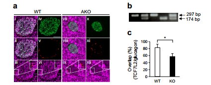 DiabetologiaJnl's tweet photo. Cell autonomous role for #TCF7L2 in the pancreatic alpha cell @gdsxavier @guy_rutter https://t.co/pQacawMAGK https://t.co/I13B0CWh21