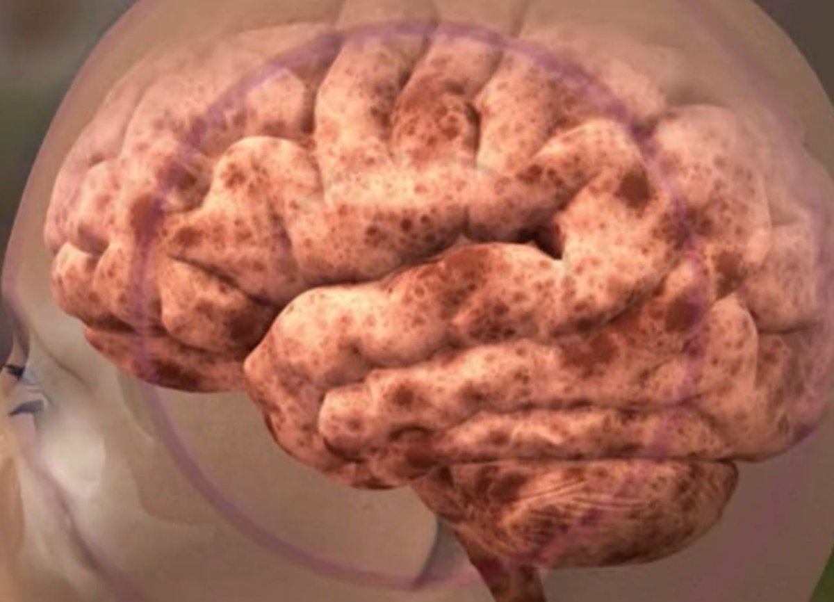 Uwe Gradwohl tweet media