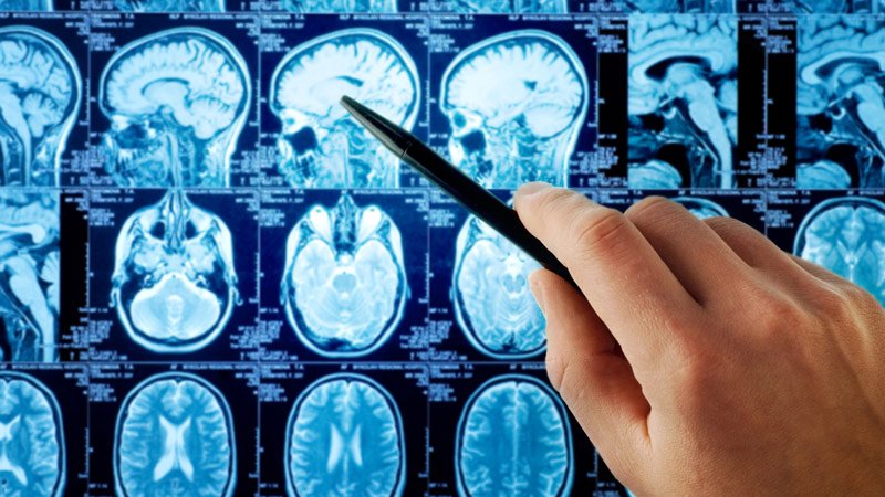 Brain Tumour 17 Braintumour17 Twitter Brain Tumour 17 Braintumour17 Twitter