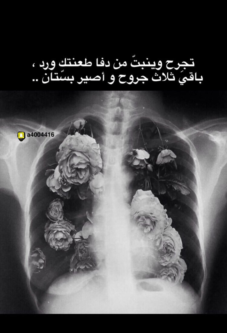 حياكم الله تابعونا سناب لمشاهدة المزيد من الصور الشعريه snapchat.com/add/a4004416  #شعر_قصيد_الصوره_تتكلم_صوره_وبيتين_بيت_تصميم_قصيده_خواطر