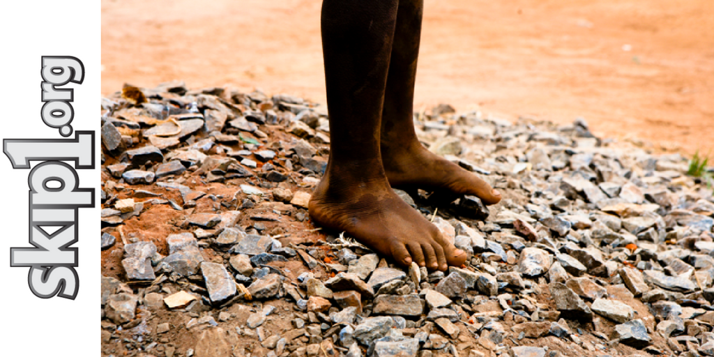 skip1's tweet photo. A skip can supply shoes to those without #OneDayWithoutShoesDay #shoes #skip1 #loveskipjump 👡👟👞👠👢 https://t.co/ln3yvJmVHz