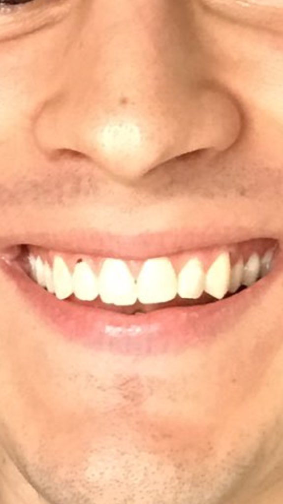 SadiaMajumder_'s tweet image. Haha #askcensor what did you eat that some was left in your teeth? 😂