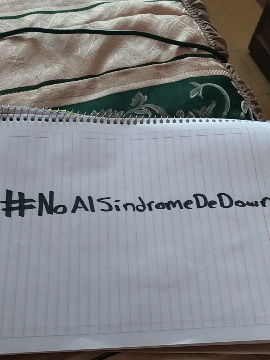 Alejandro_USR's tweet image. #NoAlSindromeDeDown Fuera ojos chuecos &amp;gt;:v