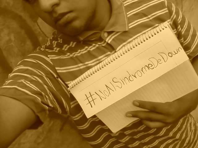 naej_cg's tweet image. Más y má gente se da cuenta de la realidad, esas bolas de carne con lag mental no deberían existir
#NoAlSindromeDeDown