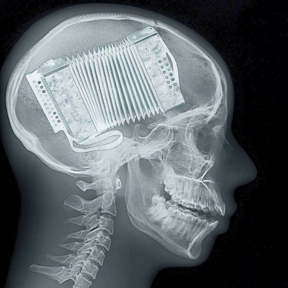 ESF? Dankzij Sieneke nog steeds trauma.....