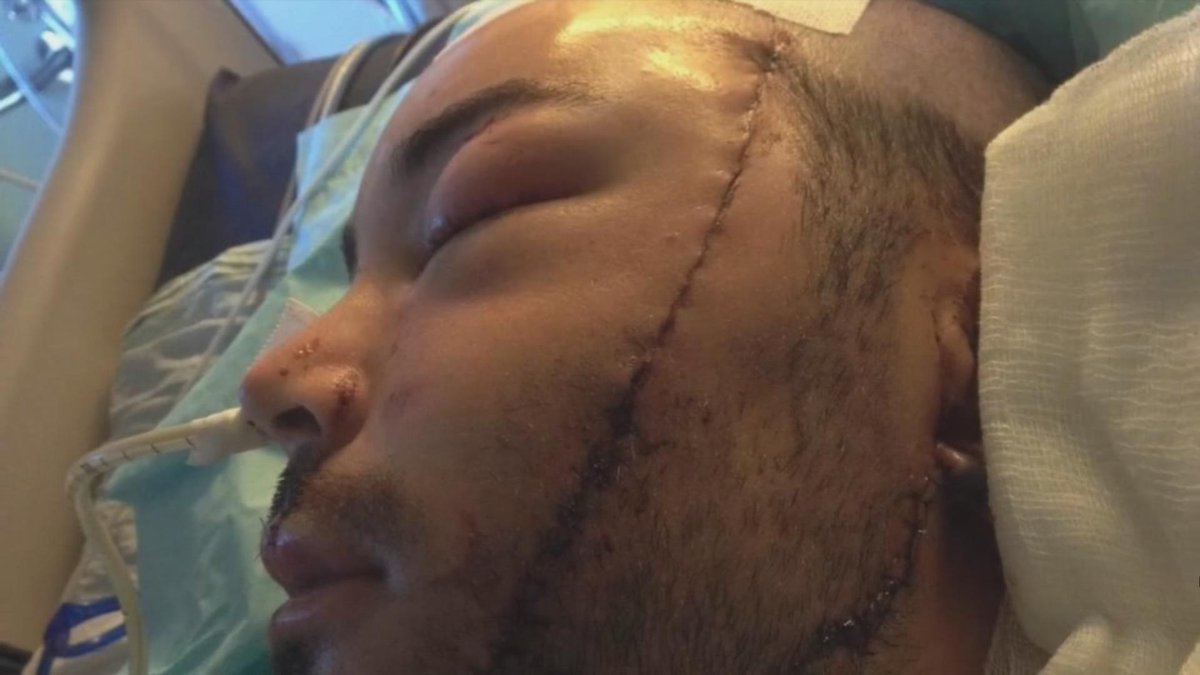 TVA Nouvelles tweet media