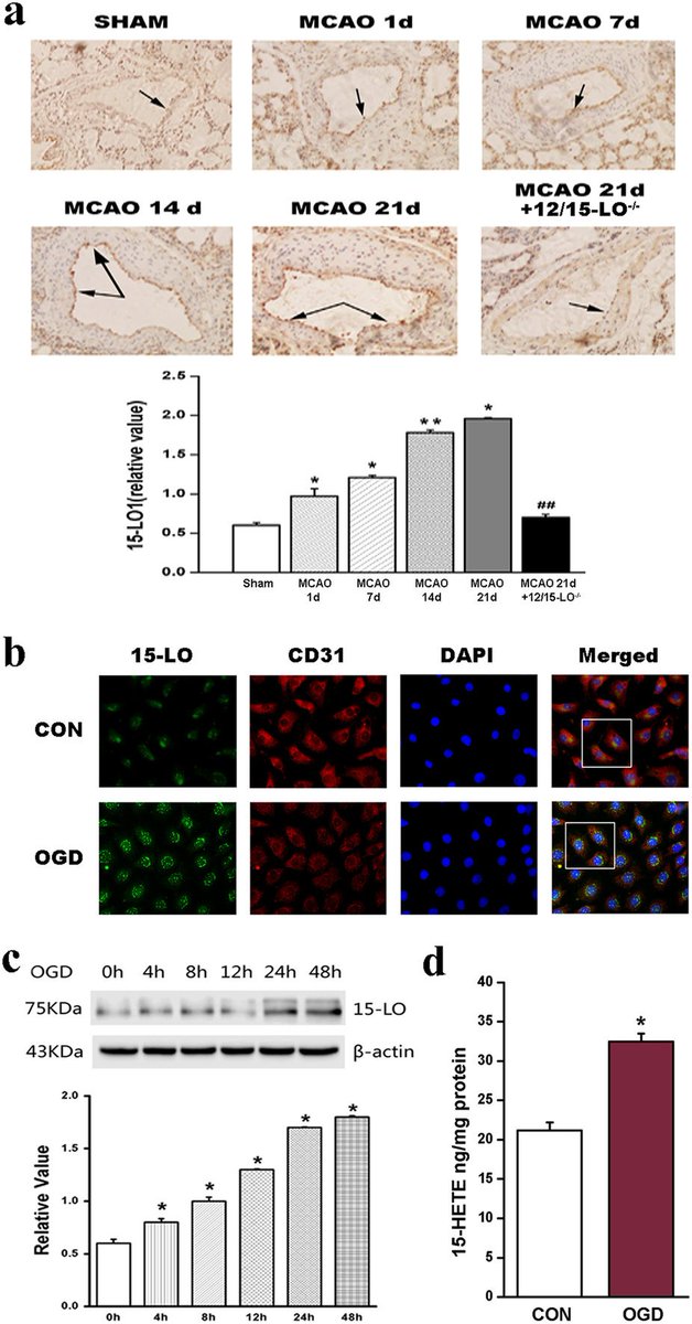 Endothelial Cell News (@endothelialnews) on Twitter photo Key Role of 15-LO/15-HETE in #Angiogenesis & Functional Recovery in Later Stages of Post-Stroke Mice <a href="/SciReports/">Scientific Reports</a> ow.ly/Bp8730bxEd8 Key Role of 15-LO/15-HETE in #Angiogenesis & Functional Recovery in Later Stages of Post-Stroke Mice <a href="/SciReports/">Scientific Reports</a> ow.ly/Bp8730bxEd8