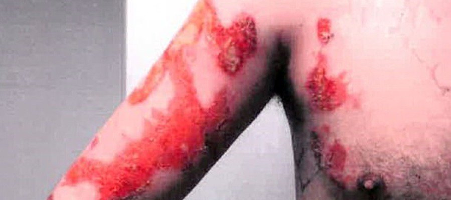 A3Noticias's tweet photo. Un jefe arroja agua hirviendo a un empleado después de que cocinase mal un huevo https://t.co/HRJcgrXAXF https://t.co/yVlxf5uCiF