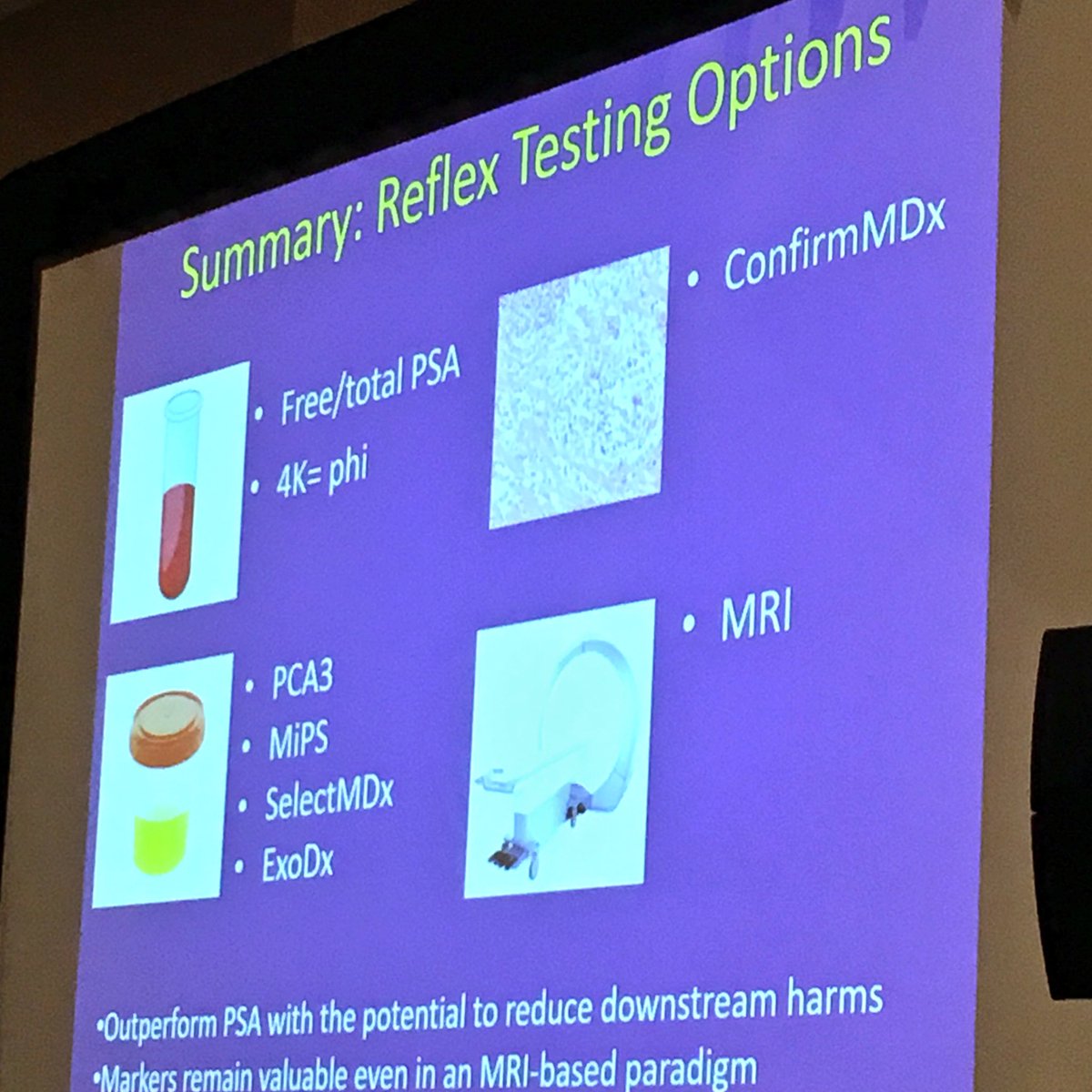Stefan W. Czarniecki (@drczarniecki) on Twitter photo New urinary markers aiding decision making in suspicion of #prostatecancer - presented by <a href="/LoebStacy/">Stacy Loeb, MD</a> at #AUA17. New trend is marker+mpMRI. New urinary markers aiding decision making in suspicion of #prostatecancer - presented by <a href="/LoebStacy/">Stacy Loeb, MD</a> at #AUA17. New trend is marker+mpMRI.