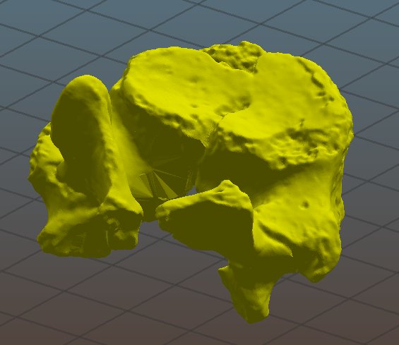 PerryNaseck's tweet photo. @Evo_Explorer @bones2bytes @Homme_inin @LeeRberger @PaleoNicole @ZCofran @Paleo_Bonegirl @FossilHistory Usually I put the model through Autodesk NetFabb (free for education) to remove the small stuff. It fills large holes roughly but properly. https://t.co/RO23nLHqRD
