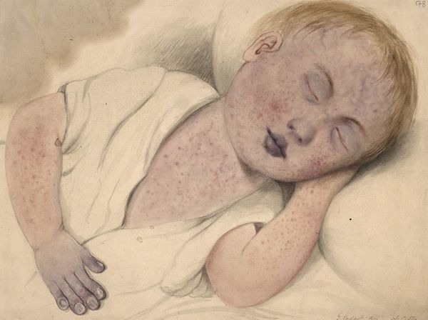 PopSci's tweet photo. Why are the measles coming back? https://t.co/lXeSuUn5qh https://t.co/awjIqFXbT3