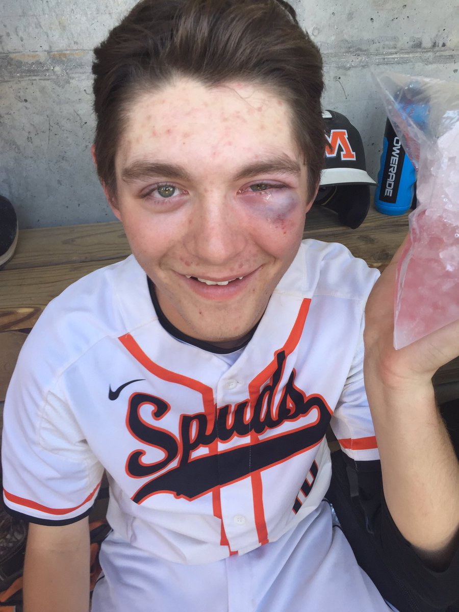 ColeOConnell's tweet photo. Took an L today @GunkelWyatt https://t.co/PFlDNe8xLH